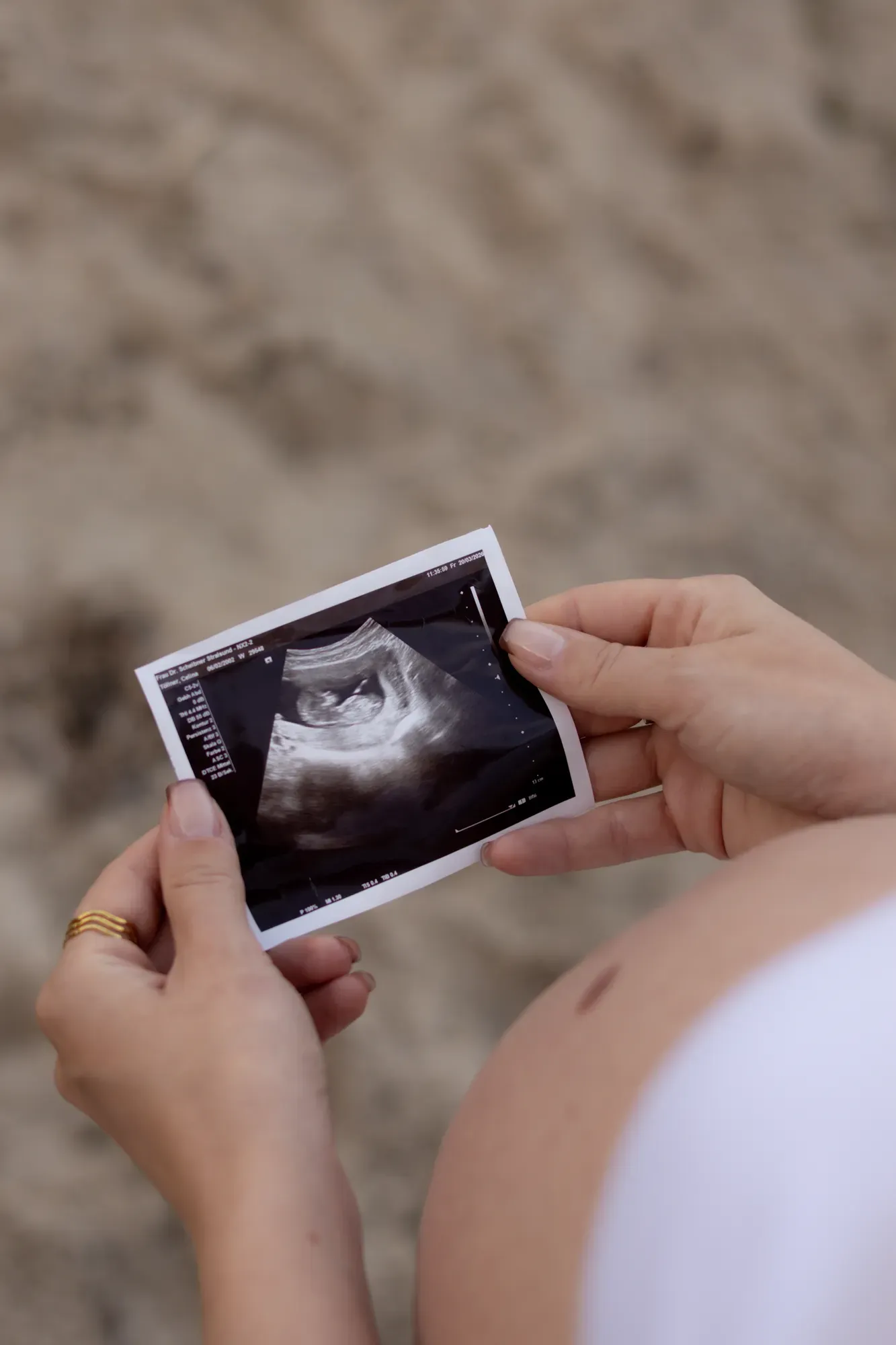 Hände halten ein Ultraschallbild, daneben der Babybauch, im Sand
